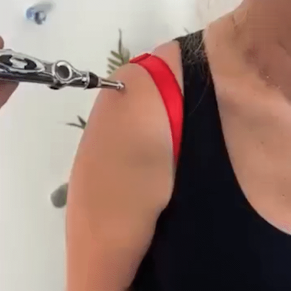 Acupuncture Healing Pen
